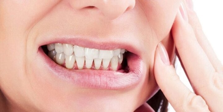 چرا دندانها زود به زود پوسیده میشوند؟